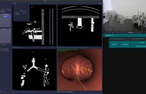 VIDEO. FOTO. România în pandemie. Cum a venit cercetarea românească în sprijinul bolnavilor de cancer