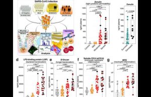 „HIV alterează mucoasa intestinală din interior, SARS-CoV-2 o alterează din exterior”